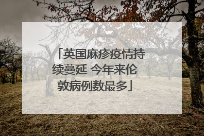 英国麻疹疫情持续蔓延 今年来伦敦病例数最多